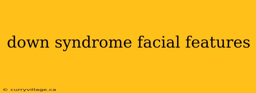 down syndrome facial features