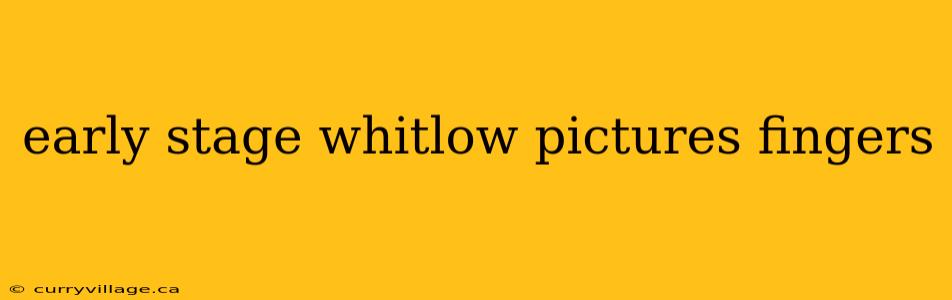 early stage whitlow pictures fingers