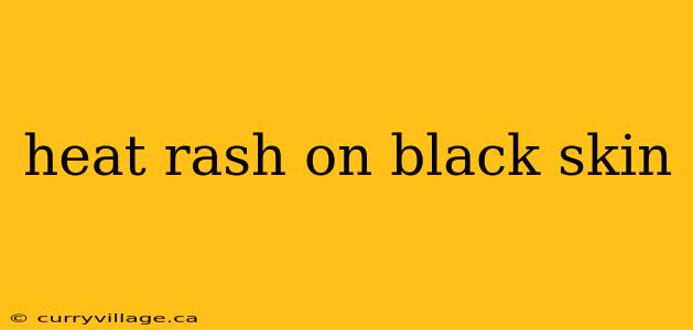 heat rash on black skin