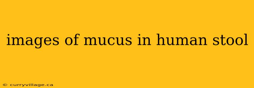 images of mucus in human stool