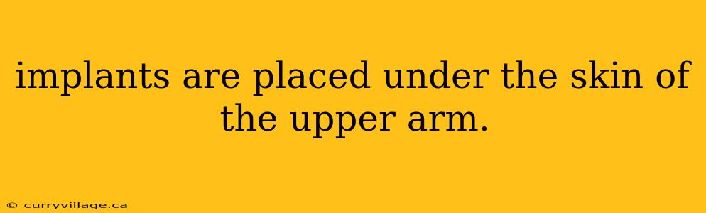 implants are placed under the skin of the upper arm.
