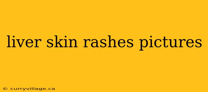 liver skin rashes pictures