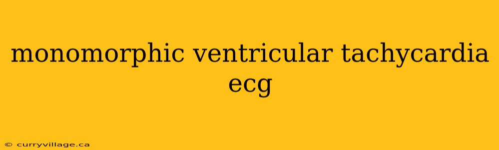 monomorphic ventricular tachycardia ecg