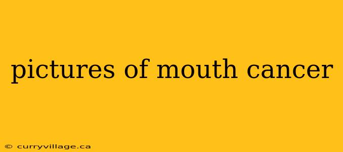 pictures of mouth cancer