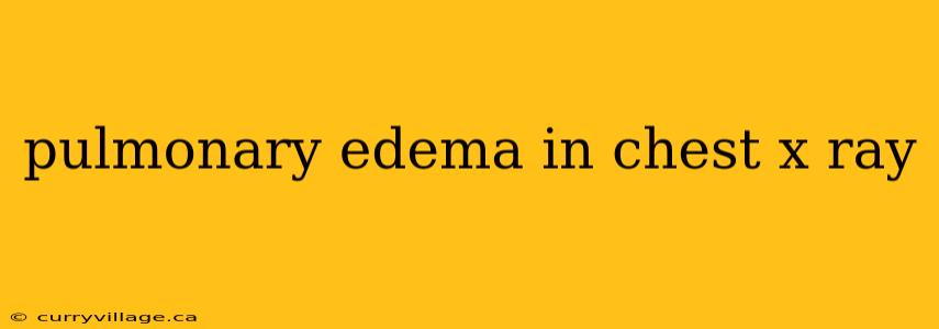pulmonary edema in chest x ray