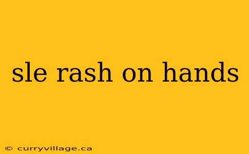 sle rash on hands
