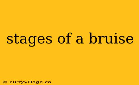 stages of a bruise