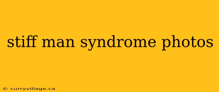 stiff man syndrome photos