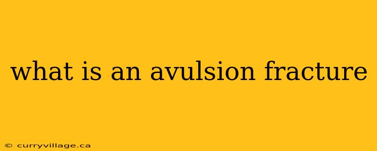 what is an avulsion fracture