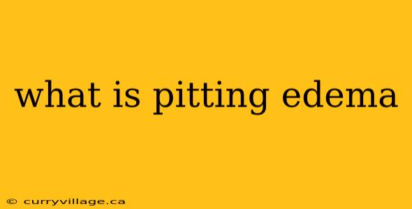 what is pitting edema