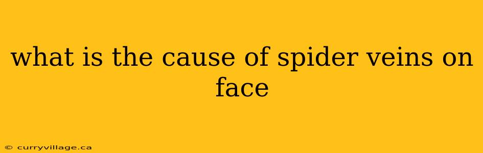 what is the cause of spider veins on face