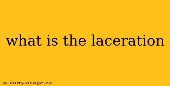 what is the laceration